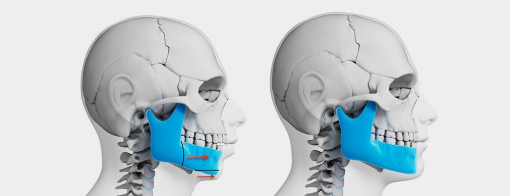 جراحی فک و صورت